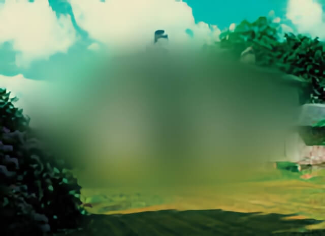 Macular Degeneration 03