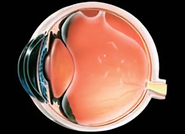 Flashers Floaters 03