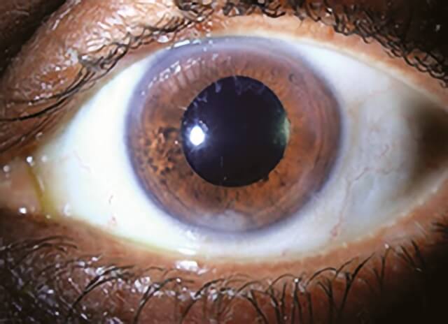 Retained Len Fragments 2