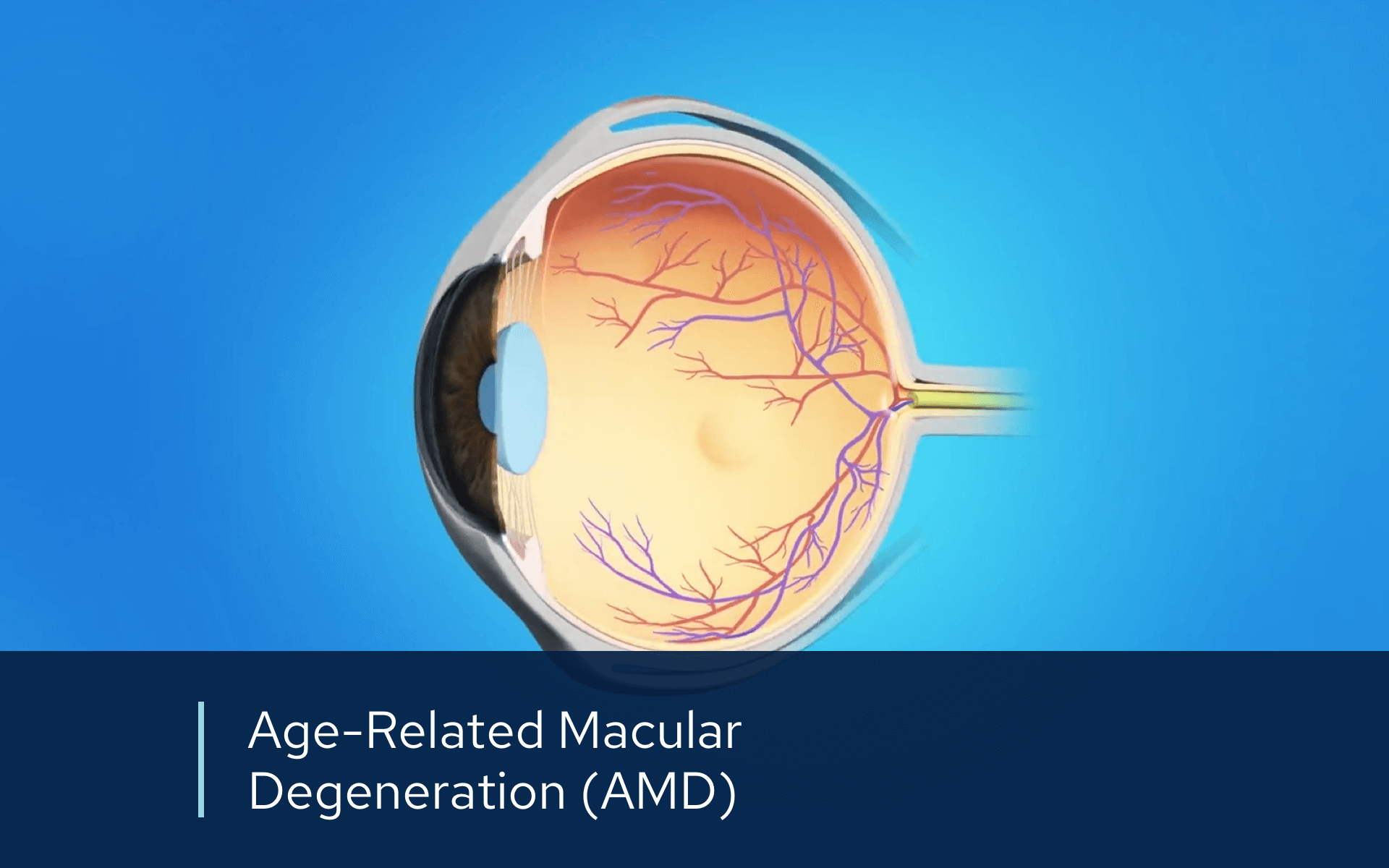 Video retina amd overview