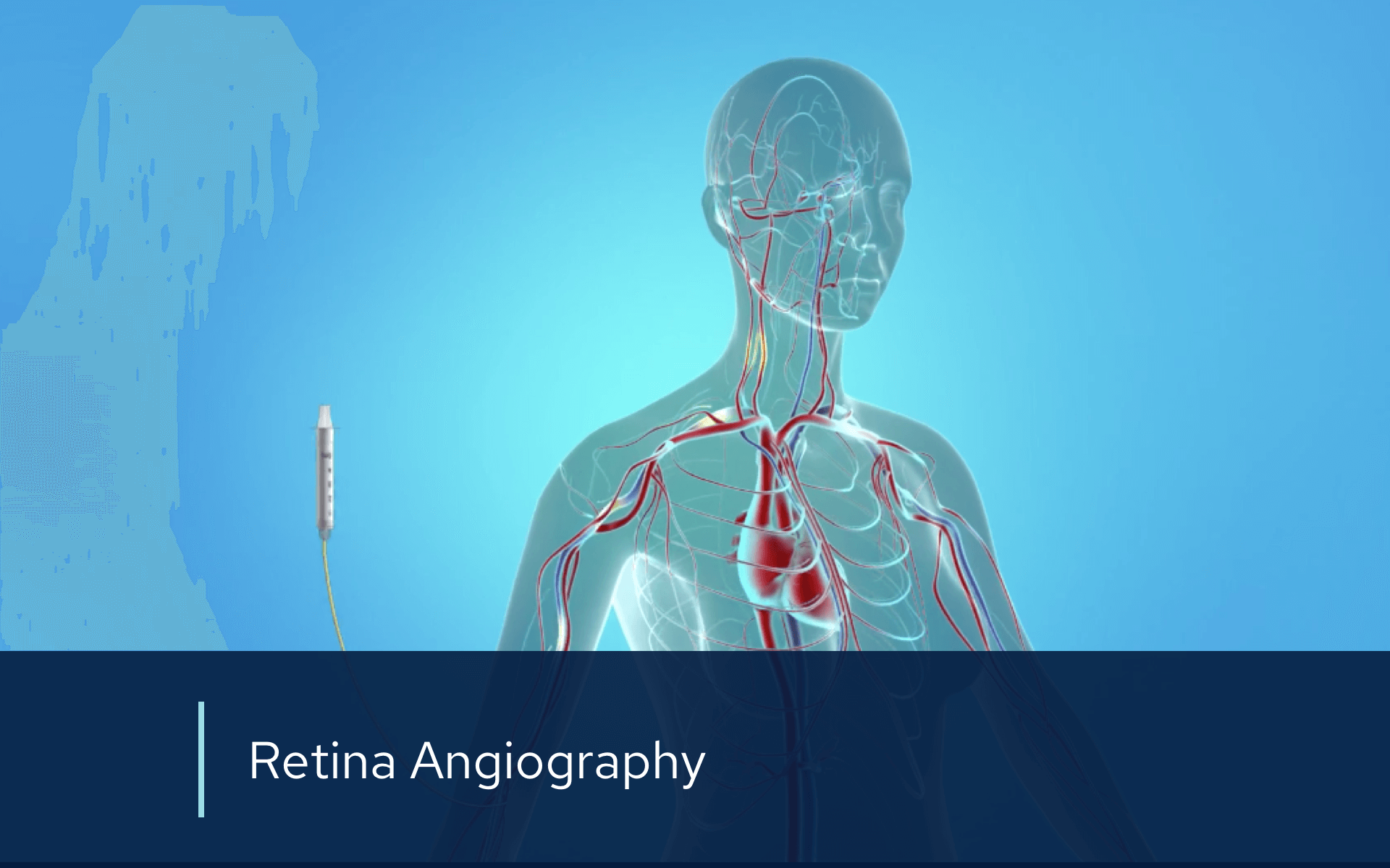 Video retina angiography